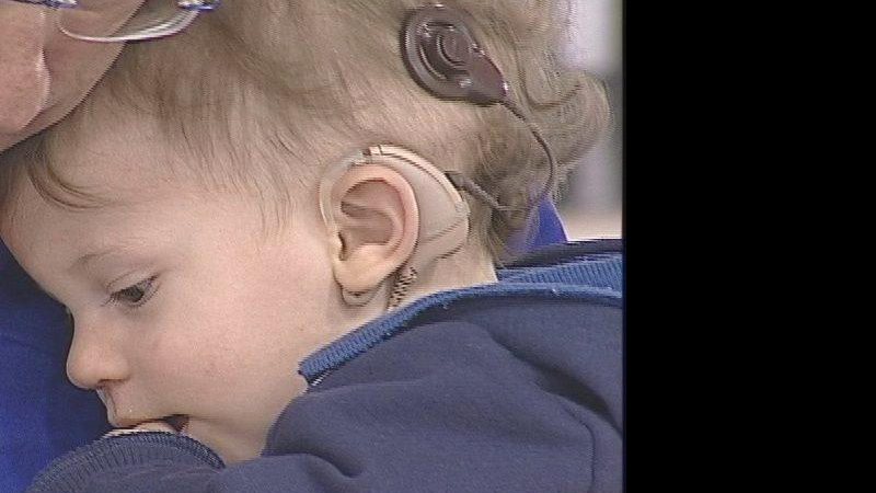 Imagem 10 de Novembro – Dia Nacional de Prevenção à Surdez. Crianças com deficiência auditiva já contam com a opção do implante coclear