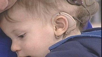 Imagem 10 de Novembro – Dia Nacional de Prevenção à Surdez. Crianças com deficiência auditiva já contam com a opção do implante coclear