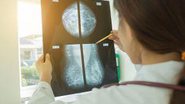 Imagem Mamografias caem 46,4% na rede privada durante a pandemia