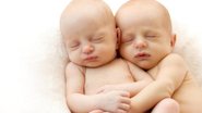 Imagem Conheça a síndrome rara que afeta até 15% das gestações de gêmeos que dividem a mesma placenta