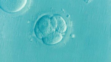 Imagem Transferir um único embrião pode ser melhor que dois