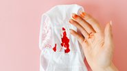 No Brasil, nem todas as mulheres possuem o direito de menstruar com dignidade
