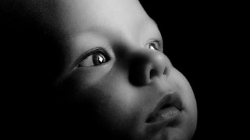 O ideal é o bebê ser levado ao oftalmologista no primeiro ano de vida