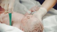 problemas cardíacos em bebês podem ser diagnosticados no nascimento ou até antes, no pré-natal